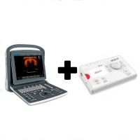 Savings pack: Chison ECO 2 Ultrasound Machine with 10 Mhz Linear Probe+ APS e4 therapeutic percutaneous electrolysis device Savings pack: Chison ECO 2 Ultrasound Machine with 10 Mhz Linear Probe+ APS e4 therapeutic percutaneous electrolysis device
